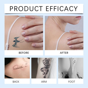 Tattoo Dissolving Gel - Simplr Deals enjoy 50% Off Today!