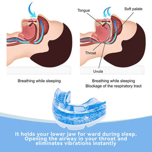 Honex Anti Snoring Mouthpiece Improve Sleep