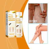 Varicose Vein Relief Spray